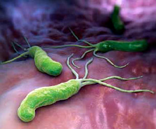 Helicobacter Pylori